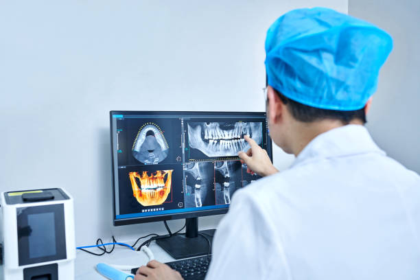 Best Emergency Dentist for Lost Fillings or Crowns in Brent, AL